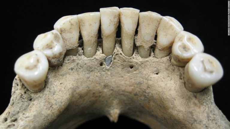 中世ドイツの修道女の歯から高価な顔料が検出された/Christina Warinner/Max Planck Institute