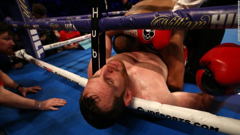 対戦相手の体に噛みついたヘビー級ボクサーに６カ月の出場停止処分/Jan Kruger/Getty Images Europe/Getty Images
