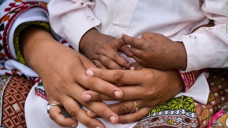 ＨＩＶに感染した子どもを抱く女性＝８日、パキスタン・シンド州ラトデロ/RIZWAN TABASSUM/AFP/AFP/Getty Images