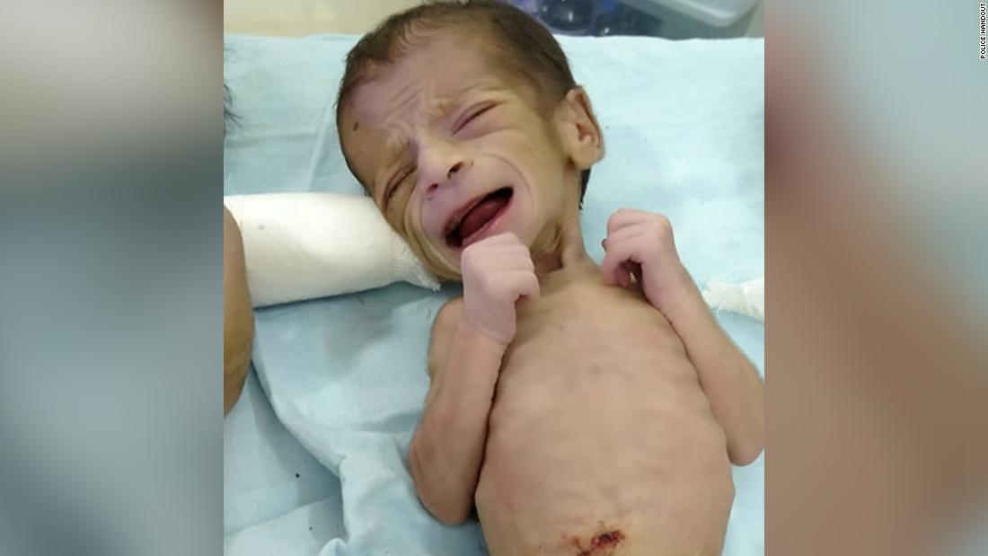 Cnn Co Jp 生きたまま埋葬された新生児 墓地で救出 インド Cnn Co Jp 生きたまま埋葬された新生児 墓地で救出 インド