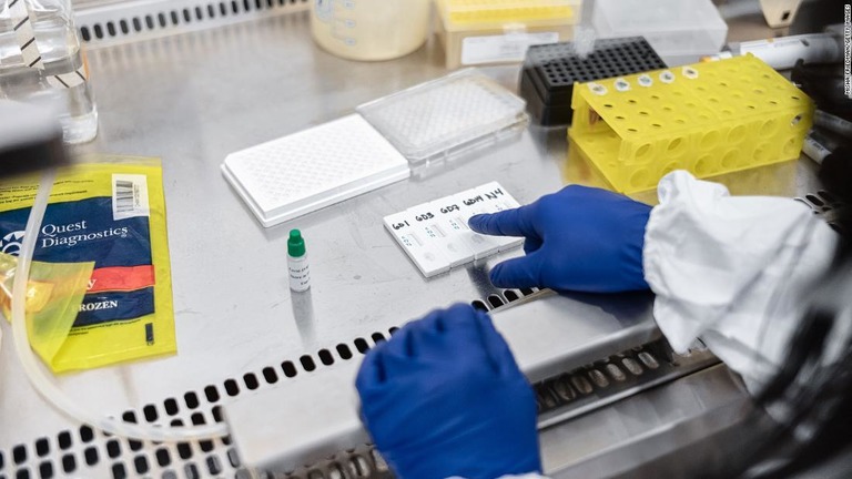 米ＣＤＣが新型コロナの抗体検査に関する新しい指針を発表した/Misha Friedman/Getty Images 