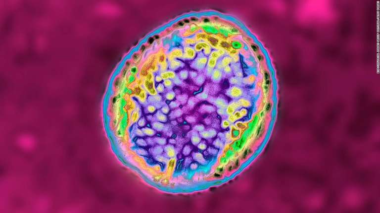 ブルセラ症を引き起こす細菌の顕微鏡画像/BSIP/Universal Images Group Editorial/Getty Images