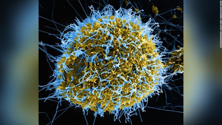 ギニアでエボラウイルスの流行が再燃している/NIAID/BSIP/Universal Images Group Editorial/Getty Images