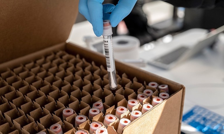米サンフランシスコの検査施設で箱に収められる新型コロナの検査用綿棒/David Paul Morris/Bloomberg/Getty Images
