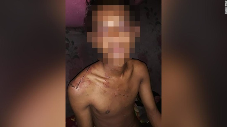 １９歳の少年は、軍の収容所で拘束されている間繰り返し殴られた/Obtained by CNN