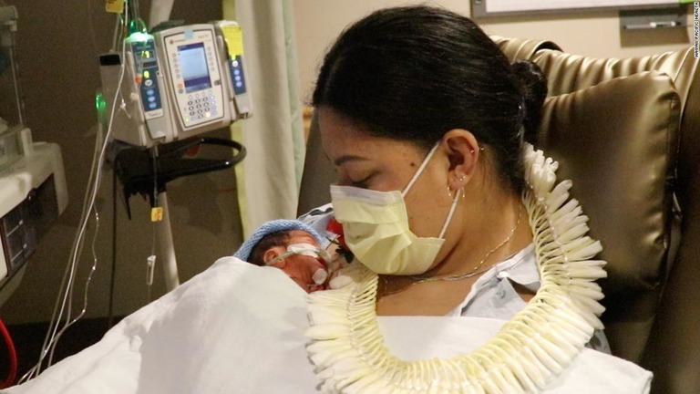 ハワイへ向かう機内で妊娠８カ月の女性が男児を出産し、偶然乗り合わせた医師と新生児集中治療室（ＮＩＣＵ）の看護師らが見事な対応で到着までの数時間を乗り切った/Hawaii Pacific Health