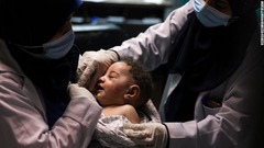 負傷した赤ちゃんを抱く看護師。赤ちゃんは空爆によって破壊された建物から救出された＝１５日、ガザ地区