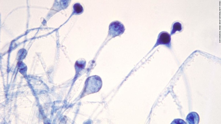 「黒い真菌」は湿った表面に見つかるムコール菌によって引き起こされる/BSIP/Universal Images Group Editorial/Getty Images