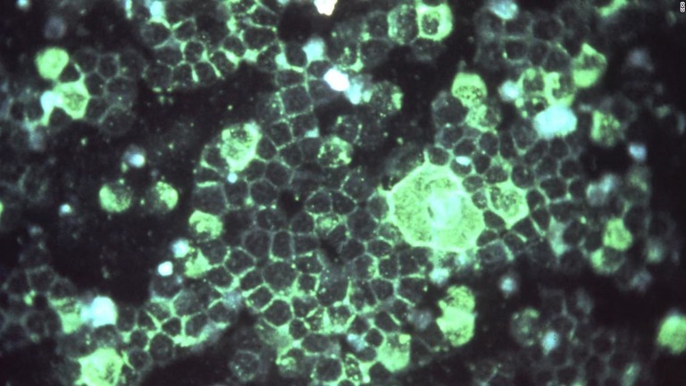 蛍光顕微鏡でみたＲＳウイルス/CDC