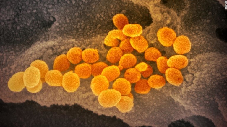 電子顕微鏡で見た新型コロナウイルス/NIAID-RML