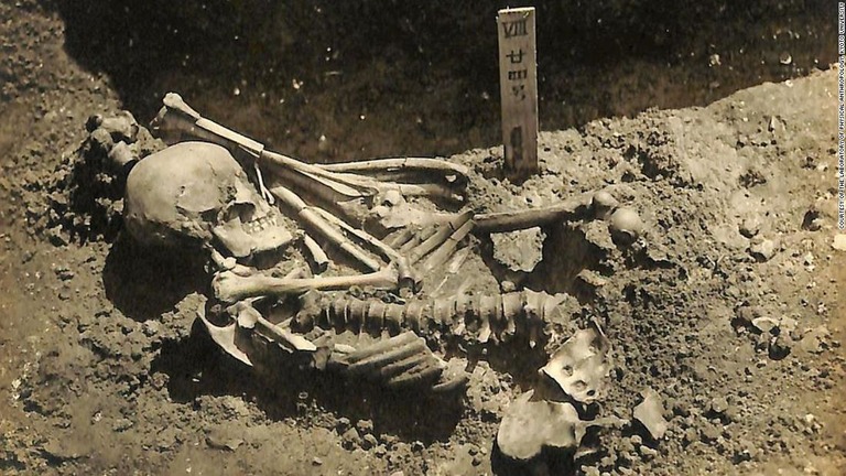 津雲貝塚から発掘された成人男性の遺骨/Courtesy of the Laboratory of Physical Anthropology, Kyoto University