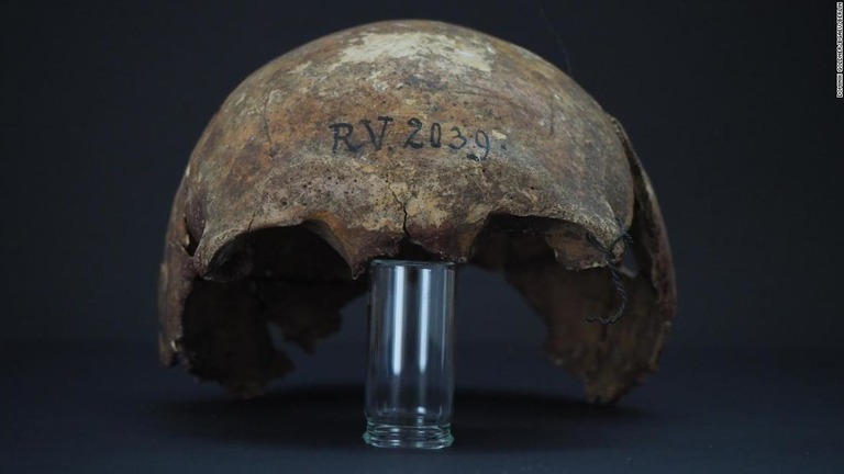 約５０００年前にラトビアで埋葬された男性の頭蓋骨（ずがいこつ）/Dominik Göldner/BGAEU/Berlin