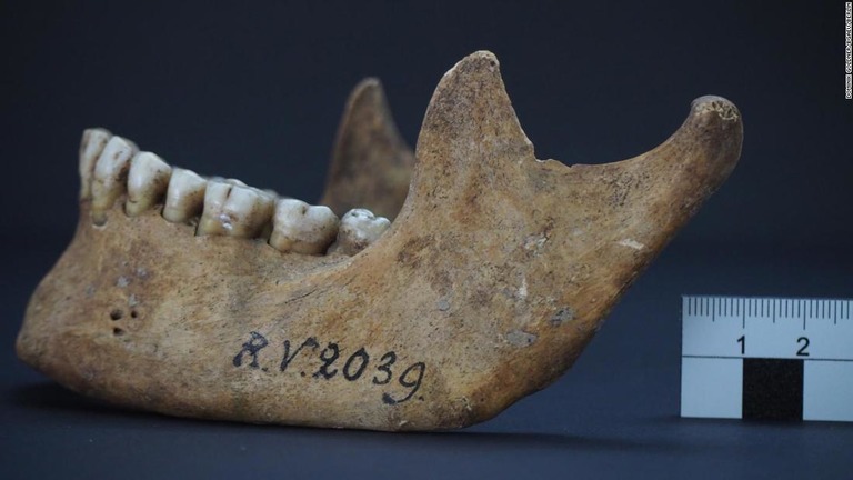 約５０００年前に埋葬された男性のあごの骨/Dominik Göldner/BGAEU/Berlin