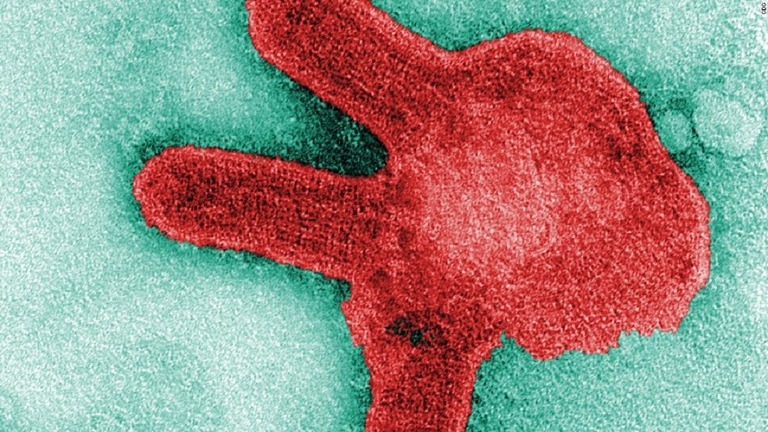 マールブルグ病のウイルスの顕微鏡画像/CDC