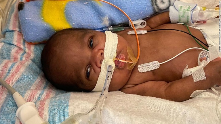 Cnn Co Jp 妊娠２１週で生まれた男児が１歳に ギネス記録認定 米アラバマ州 1 2