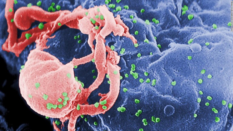 ＨＩＶ感染の診断から８年たち、女性患者の体内に増殖可能なウイルスに見当たらなかった/Smith Collection/Gado/Getty Images