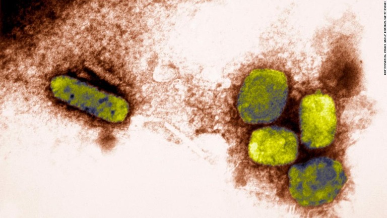 天然痘ウイルスの電子顕微鏡写真/BSIP/Universal Images Group Editorial/Getty IMages