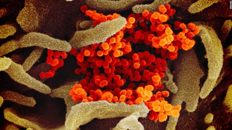 走査電子顕微鏡で見た新型コロナウイルス/NIAID-RML
