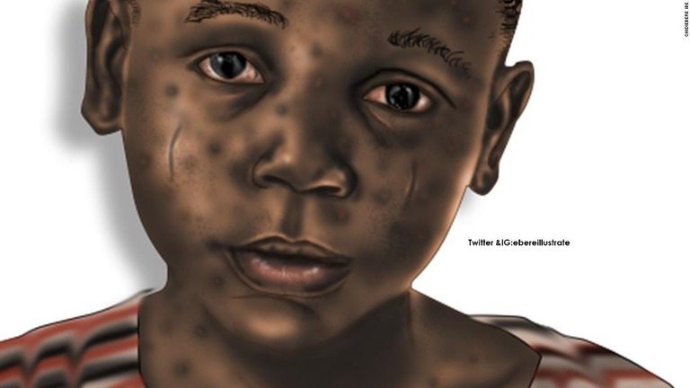 イベさんは子どもの先天性欠損についての教科書に取り組んでいる。挿絵には黒人の皮膚のイラストを使うという/Chidiebere Ibe