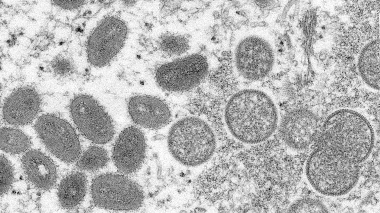 ２００３年にプレーリードッグから感染した患者から採取されたサル痘のウイルス粒子の顕微鏡画像/Cynthia S. Goldsmith, Russell Regner/CDC/AP