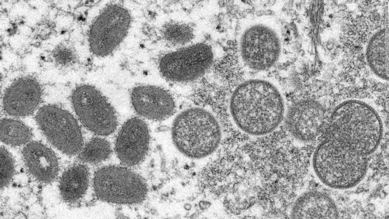 欧米を中心に感染報告が相次ぐサル痘ウイルスの電子顕微鏡画像/Cynthia S. Goldsmith, Russell Regner/CDC via AP