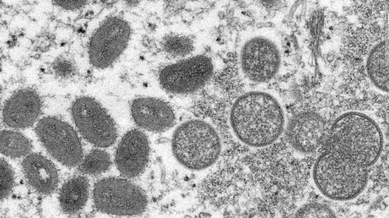 サル痘のウイルス粒子の電子顕微鏡画像/Cynthia S. Goldsmith, Russell Regner/CDC/AP