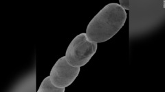 世界最大の細菌発見　長さ１センチ、人に例えれば「エベレスト並みの身長」