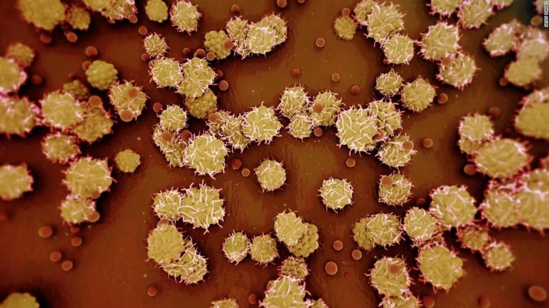 米政府がサル痘の流行について公衆衛生上の非常事態を宣言した/Getty Images