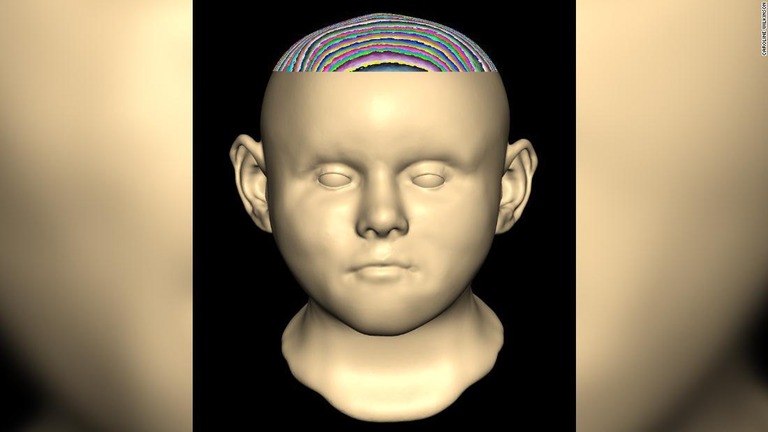 中世の井戸から見つかった幼児の顔の遺骨をデジタルで復元した画像/Caroline Wilkinson