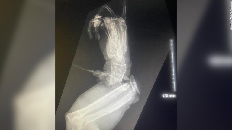 グラジャーニさんの腕が負った損傷を示すＸ線写真/Courtesy of Floria Gator Gardens