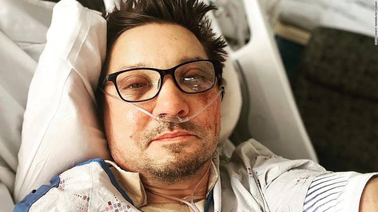 顔にけがを負った写真を投稿したジェレミー・レナーさん/From Jeremy Renner/Instagram