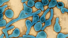 アフリカ２カ国でマールブルグ病が発生、米ＣＤＣが注意喚起