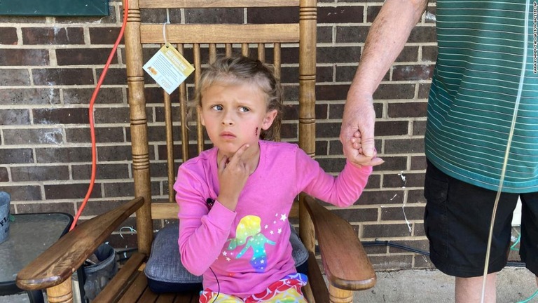 顔に残った傷を記者団に見せる６歳のキンズリーさん/Kara Fohner/The Gaston Gazette/AP