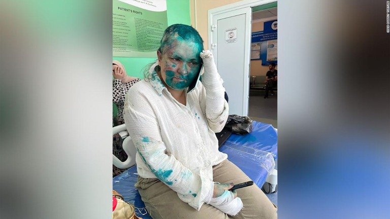ロシア人ジャーナリスト、エレナ・ミラシナさんが襲われ、緑色の塗料を浴びせられた/Crew Against Torture
