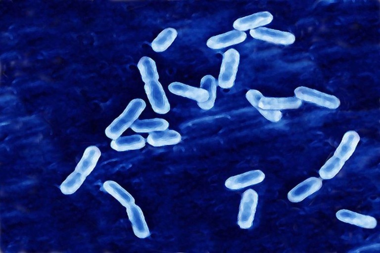 米ワシントン州で、食中毒菌のリステリアに感染した患者５人のうち３人が死亡した/BSIP/UIG Via Getty Images