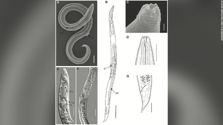 線虫はシベリアの永久凍土から発見された/Shatilovich et al, 2023, PLOS Genetics, CC-BY 4.0