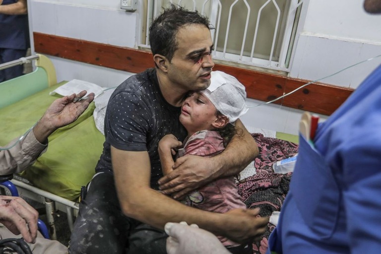 負傷した自分の子どもを抱きしめるパレスチナ人男性＝１０月３０日、パレスチナ自治区ガザ地区/ Abed Rahim Khatib/dpa/AP