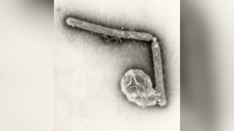 米国で畜牛の鳥インフルエンザ感染が拡大し、人に感染した米国内２例目の症例が確認された/CDC