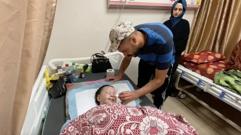 ガザ中部にあるアクサ殉教者病院のベッドで治療を受けるハナンさん/Mohammad Al-Sawalhi/CNN