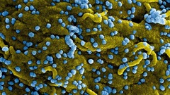 マールブルグ病で８人死亡、ルワンダで初　致死率８８％