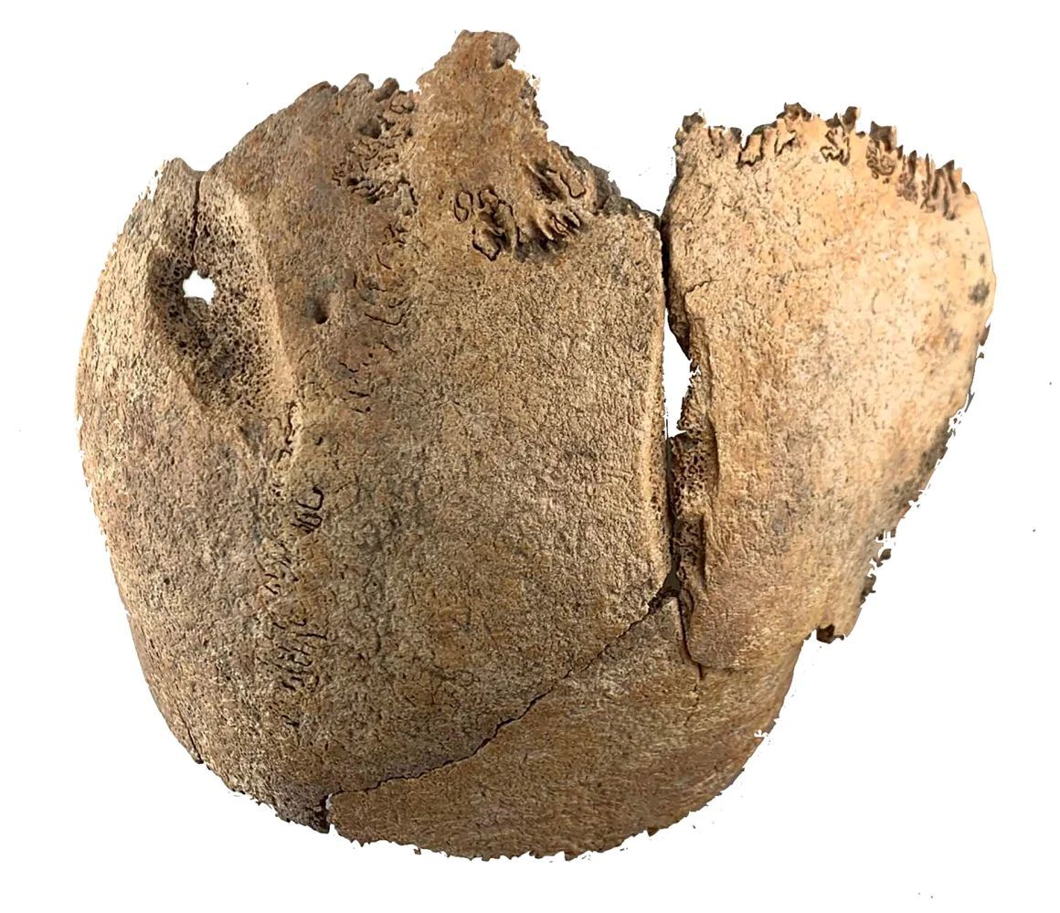戦闘によるものとみられる傷痕が残る頭蓋骨/Urban Archeology Vienna