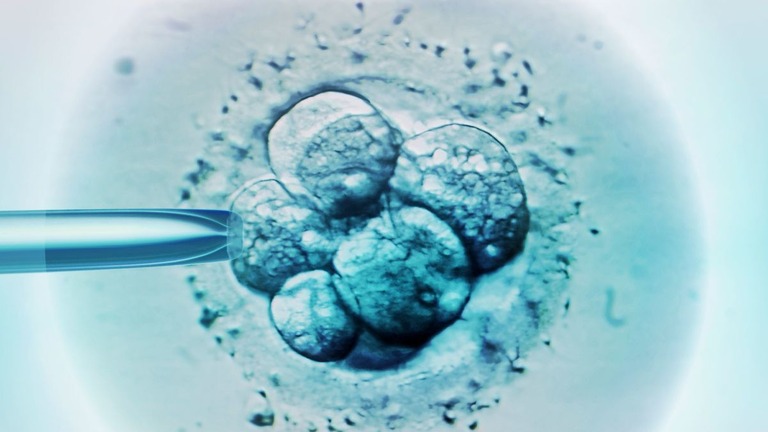 女性が体外受精で誤った胚を移植され、別の夫婦の子どもを出産する事例が豪州で起きた/Science Photo Library/ZEPHYR/Brand X/Getty Images