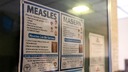 はしか流行、全米の半数の州に　感染者８００人超える