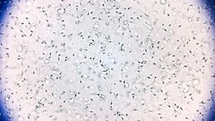 まれな変異遺伝子持つ精子ドナーから６７人の子ども、１０人ががんに　規制求める声
