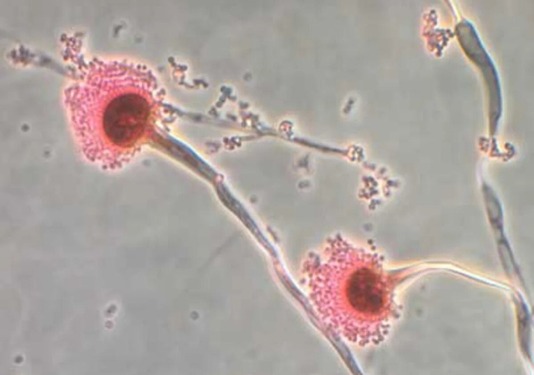新たな研究によれば、真菌の一種「アスペルギルス属」は温暖化に伴い生息域を拡大している/Centres for Disease Control/Reuters