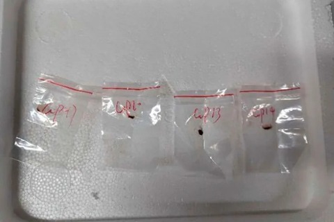 生物学的病原体の密輸試みた疑い、中国人研究者２人を訴追　米検察