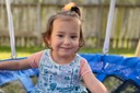 未熟児の女の子が感染症で負った重傷、敗血症を起こすも「魚の皮」で劇的な治癒　米