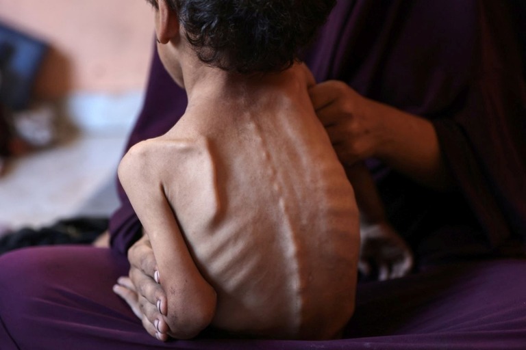 ガザの難民キャンプで２歳の息子をひざに乗せる母親＝２３日/Omar Al-Qattaa/AFP/Getty Images