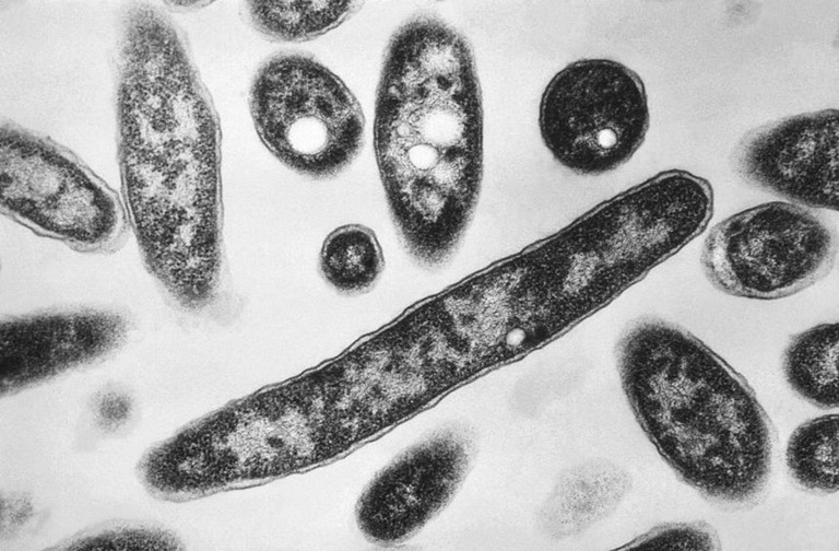 米ニューヨーク市でレジオネラ菌の集団感染が発生した/Francis Chandler/CDC/AP