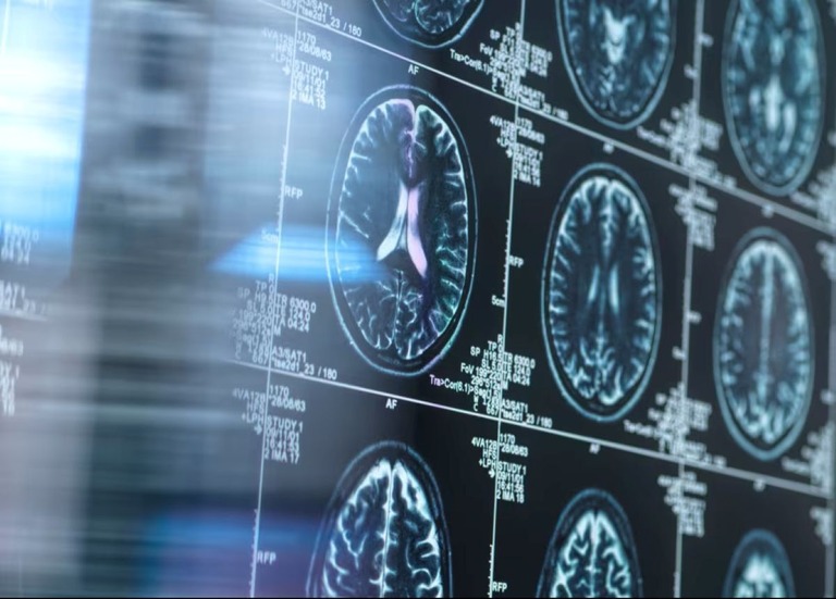 マウスによる実験でリチウムが人間の脳の健康に一定の役割を果たす可能性が示唆された/Tek Image/Science Photo Library RF/Getty Images